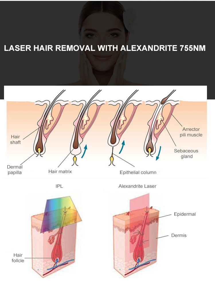 Long Pulsed ND YAG 1064nm Alexandrite 755nm Laser Gentle PRO Laser for Hair Removal
